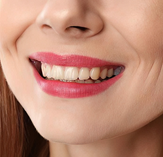 <span class="bt_bb_before_after_image_after_text"> Sonrası</span>